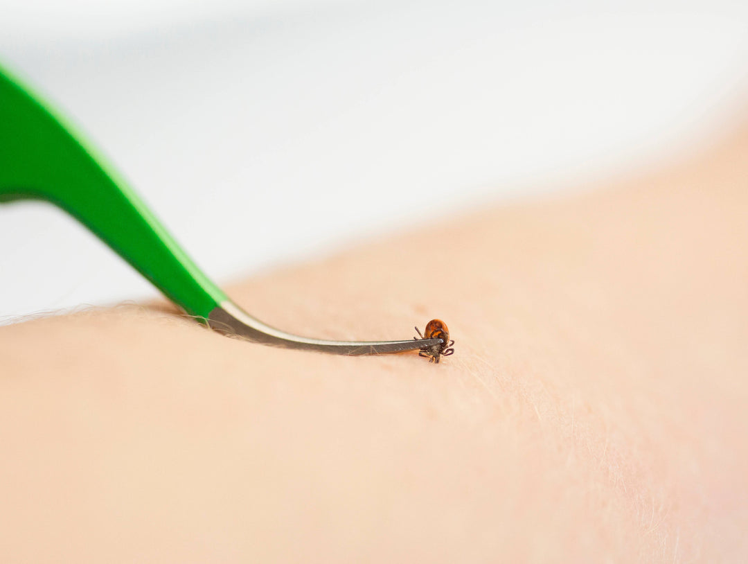 Premium Tick Remover Kit