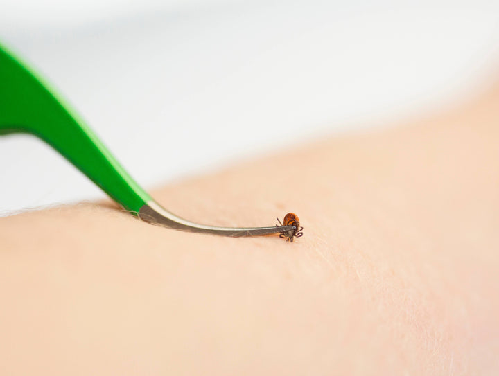 Premium Tick Remover Kit